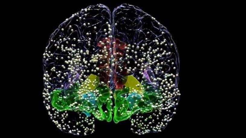 درمان افسردگی با شبیه سازی جریان های الکتریکی مغز